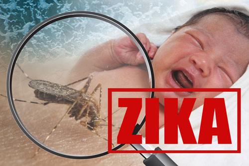 Pregnant Women In U.s. With Confirmed Zika Virus